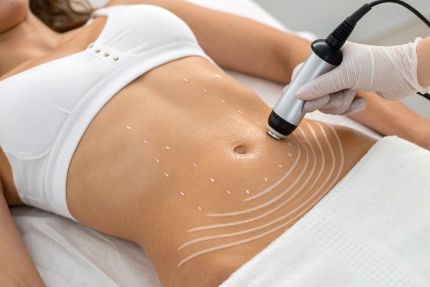 Ультразвуковая кавитация на животе для уменьшения жира