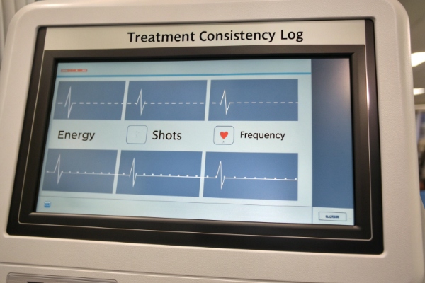 Behandlungs-Konsistenzprotokoll-Bildschirm mit Anzeige von Energie-, Schuss- und Frequenzwellenformen (ID#4)